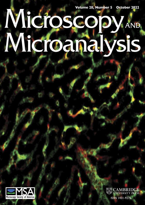 microscopy and micoranalysis